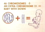 http://healthylifemed.com/down-syndrome/